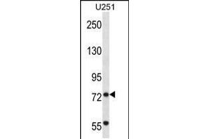 Western blot analysis in U251 cell line lysates (35ug/lane). (TRIM2 Antikörper  (C-Term))