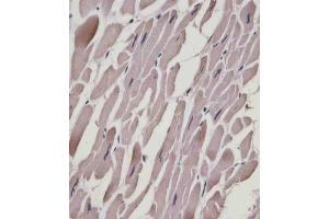(ABIN6243895 and ABIN6578867) staining MYL1 in human heart tissue sections by Immunohistochemistry (IHC-P - paraformaldehyde-fixed, paraffin-embedded sections). (MYL1 Antikörper  (AA 24-58))