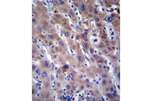 FADS2 Antibody immunohistochemistry analysis in formalin fixed and paraffin embedded human liver tissue followed by peroxidase conjugation of the secondary antibody and DAB staining. (FADS2 Antikörper  (N-Term))