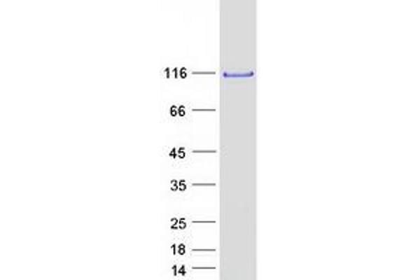 CNOT3 Protein (Myc-DYKDDDDK Tag)