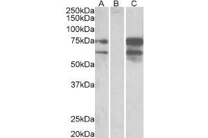 Western Blotting (WB) image for anti-Neurexin 1 (NRXN1) antibody (ABIN5887202) (Neurexin 1 Antikörper)