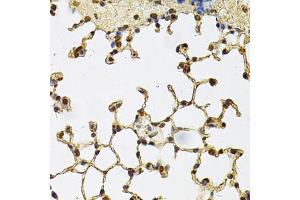 Immunohistochemistry of paraffin-embedded mouse lung using IFI16 Antibody (ABIN6291165) at dilution of 1:100 (40x lens). (IFI16 Antikörper)