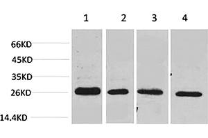 Western blot analysis of 1) MCF7, 2) Mouse Heart tissue, 3) Rat Heart tissue, 4) rat brain tissue using SLUG Polyclonal Antibody. (SLUG Antikörper)