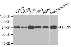Western blot analysis of extracts of various cells, using FBLN5 antibody. (Fibulin 5 Antikörper)