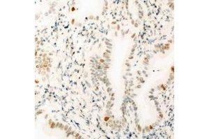 Immunohistochemical analysis of THOC1 staining in mouse kidney formalin fixed paraffin embedded tissue section. (THOC1 Antikörper)