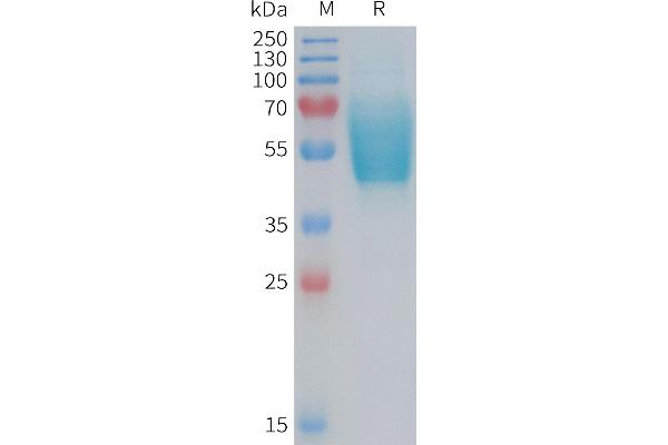 CALCRL Protein (AA 23-140) (mFc Tag)