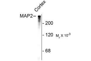 Image no. 1 for anti-Microtubule-Associated Protein 2 (MAP2) antibody (ABIN372661) (MAP2 Antikörper)