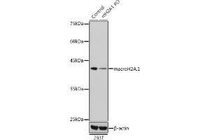 Western blot analysis of extracts from normal (control) and macroH2A. (H2AFY Antikörper  (AA 123-372))