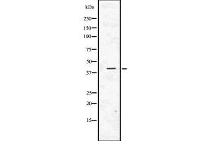 Western blot analysis of ACTC1 using Jurkat whole  lysates. (ACTC1 Antikörper  (N-Term))