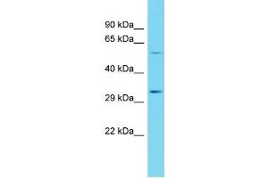 Host: Rabbit Target Name: CDKL4 Sample Type: Fetal Heart lysates Antibody Dilution: 1. (CDKL4 Antikörper  (N-Term))