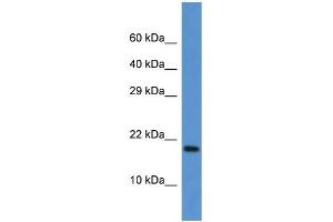 WB Suggested Anti-Fxn Antibody Titration: 1. (Frataxin Antikörper  (C-Term))