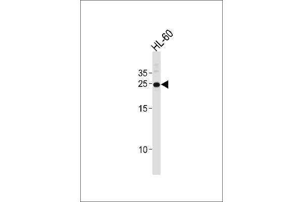 HOXA6 Antikörper  (AA 105-133)