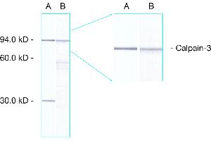 Western Blot: analysis of human skeletal muscle showing detection of calpain 3 proteins. (Calpain Antikörper  (AA 1-19))