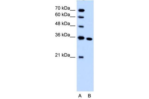 SLC25A29 Antikörper  (C-Term)