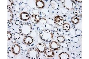 Immunohistochemical staining of paraffin-embedded Kidney tissue using anti-PSMC3 mouse monoclonal antibody. (PSMC3 Antikörper)