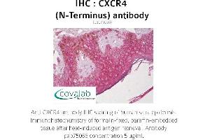 Image no. 1 for anti-Chemokine (C-X-C Motif) Receptor 4 (CXCR4) antibody (ABIN1733408) (CXCR4 Antikörper)