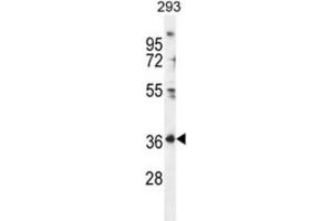 Western Blotting (WB) image for anti-Folate Receptor 4 (Delta) (FOLR4) antibody (ABIN2996480) (Folate Receptor 4 Antikörper)