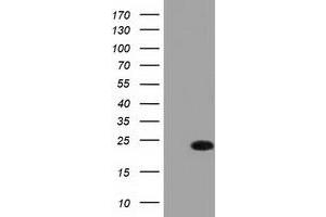 Western Blotting (WB) image for anti-Fas (TNFRSF6)-Associated Via Death Domain (FADD) antibody (ABIN1498178) (FADD Antikörper)