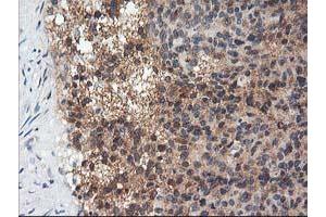 Immunohistochemical staining of paraffin-embedded Human breast tissue using anti-ADIPOQ mouse monoclonal antibody. (ADIPOQ Antikörper  (AA 19-244))