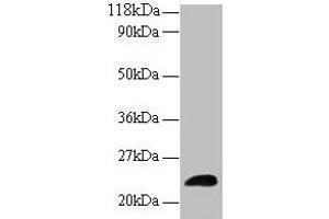 Western blot All lanes: LCN2 antibody at 2 μg/mL + Human positive serum Secondary Goat polyclonal to rabbit IgG at 1/15000 dilution Predicted band size: 23 kDa Observed band size: 23 kDa (Lipocalin 2 Antikörper  (AA 1-198))