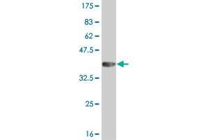 Western Blot detection against Immunogen (36. (IRAK2 Antikörper  (AA 111-210))