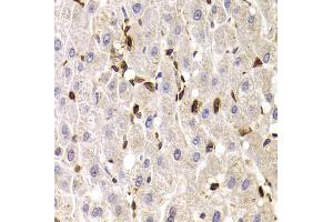 Immunohistochemistry of paraffin-embedded human liver injury using SPN antibody. (CD43 Antikörper)