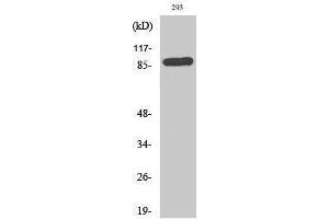 Western Blotting (WB) image for anti-Transferrin Receptor (p90, CD71) (TFRC) (Tyr154) antibody (ABIN3183784) (Transferrin Receptor Antikörper  (Tyr154))