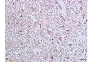 Immunohistochemistry (Paraffin-embedded Sections) (IHC (p)) image for anti-BCL2-Associated X Protein (BAX) (AA 84-175) antibody (ABIN725390)