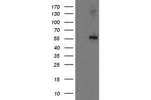 HEK293T cells were transfected with the pCMV6-ENTRY control (Left lane) or pCMV6-ENTRY PPM1B (Right lane) cDNA for 48 hrs and lysed. (PPM1B Antikörper)