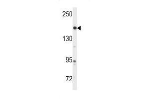 Western blot analysis of anti-ABL Antibody (Y251) in A2058 cell line lysates (35ug/lane) (ABL1 Antikörper)