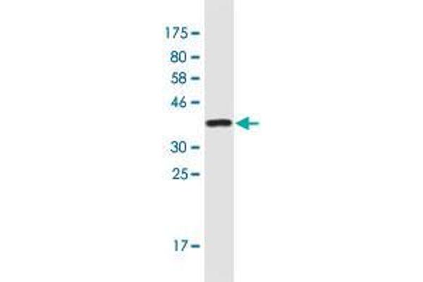 Surfactant Protein A1 Antikörper  (AA 83-199)