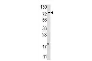 Western Blotting (WB) image for anti-Ubiquitin Specific Peptidase 16 (USP16) antibody (ABIN3001477) (USP16 Antikörper)