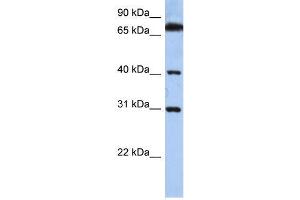 Human HeLa; WB Suggested Anti-DHRSX Antibody Titration: 0. (DHRSX Antikörper  (C-Term))