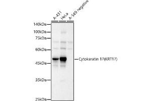 Western blot analysis of extracts of various cell lines, using Cytokeratin 17 (KRT17) antibody (ABIN6130112, ABIN6143023, ABIN6143024 and ABIN6213626) at 1:1298 dilution. (KRT17 Antikörper  (AA 133-432))