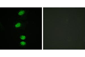 P-peptide - +Immunofluorescence analysis of HeLa cells, using Androgen Receptor (Phospho-Ser94) antibody. (Androgen Receptor Antikörper  (pSer94))