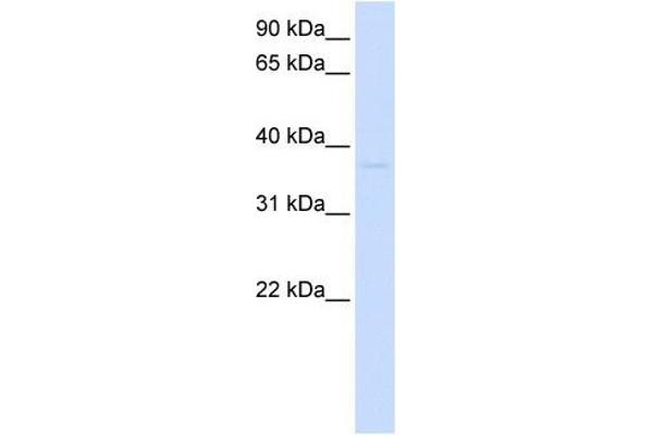 GDAP1L1 Antikörper  (N-Term)