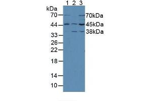 Western blot analysis of (1) Mouse Brain Tissue, (2) Mouse Kidney Tissue and (3) Rat Brain Tissue. (MEK2 Antikörper  (AA 44-313))