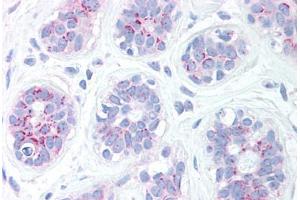 Human Breast (formalin-fixed, paraffin-embedded) stained with BBC3 antibody ABIN213906 at 10 ug/ml followed by biotinylated goat anti-rabbit IgG secondary antibody ABIN481713, alkaline phosphatase-streptavidin and chromogen. (PUMA Antikörper  (C-Term))