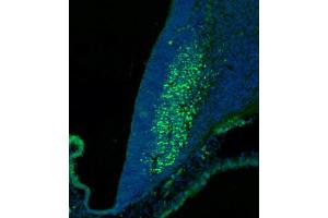 (ABIN6244147 and ABIN6577773) staining SKOR2 in mouse cerebellum at embryonic stage 12. (SKOR2 Antikörper  (C-Term))