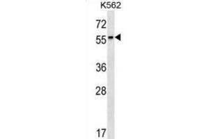 Western Blotting (WB) image for anti-Retinoic Acid Receptor, beta (RARB) antibody (ABIN2999994) (Retinoic Acid Receptor beta Antikörper)