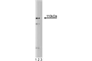 Western blot analysis of PI4-Kinase beta on a HeLa lysate. (pi 4-Kinase, beta (AA 411-626) Antikörper)