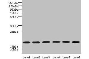 Western blot All lanes: SPATA19 antibody at 1 μg/mL Lane 1: MCF-7 whole cell lysate Lane 2: Hela whole cell lysate Lane 3: HepG2 whole cell lysate Lane 4: MDA-MB-231 whole cell lysate Lane 5: A549 whole cell lysate Lane 6: Mouse liver tissue Secondary Goat polyclonal to rabbit IgG at 1/10000 dilution Predicted band size: 20 kDa Observed band size: 20 kDa (SPATA19 Antikörper  (AA 25-167))