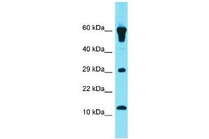 Host: Rabbit Target Name: GCSAML Sample Type: Fetal Heart lysates Antibody Dilution: 1. (GCSAML Antikörper  (N-Term))