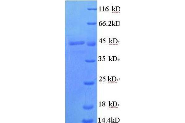 TCN1 Protein (AA 25-416, full length) (His tag)