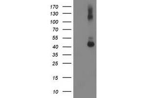 HEK293T cells were transfected with the pCMV6-ENTRY control (Left lane) or pCMV6-ENTRY GDAP1L1 (Right lane) cDNA for 48 hrs and lysed. (GDAP1L1 Antikörper)