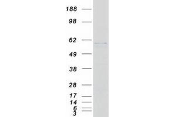 Fukutin Protein (FKTN) (Transcript Variant 1) (Myc-DYKDDDDK Tag)