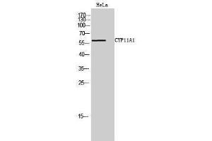 Western Blotting (WB) image for anti-Cytochrome P450, Family 11, Subfamily A, Polypeptide 1 (CYP11A1) (C-Term) antibody (ABIN3174630) (CYP11A1 Antikörper  (C-Term))