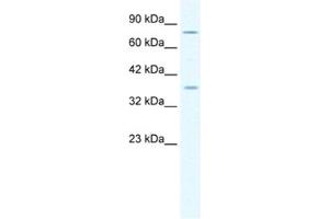 Western Blotting (WB) image for anti-Minichromosome Maintenance Deficient 4 (MCM4) antibody (ABIN2461392) (MCM4 Antikörper)