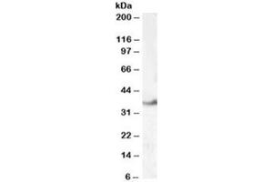 Western blot testing of human kidney lysate with LASP1 antibody at 0. (LASP1 Antikörper)