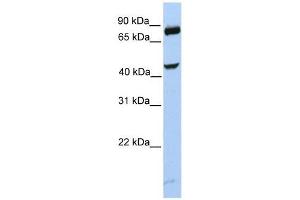 SMYD3 antibody used at 0. (SMYD3 Antikörper  (C-Term))